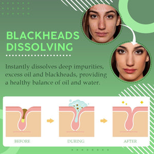 Blackhead Dissolving Gel